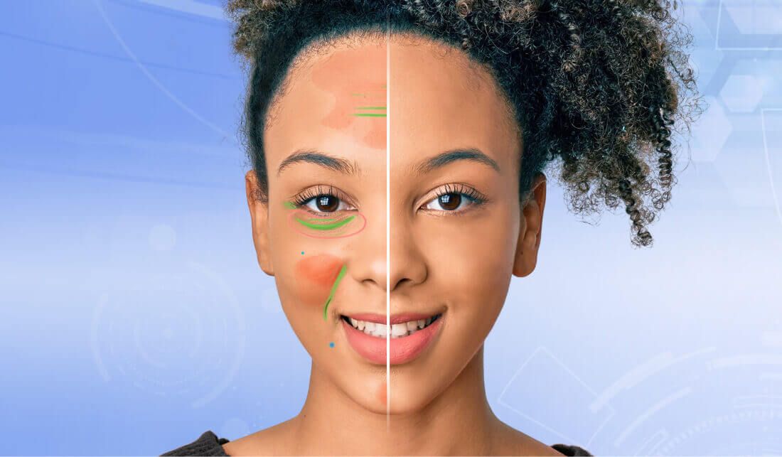 Visualize Results in Real Time with AI Skin Simulation