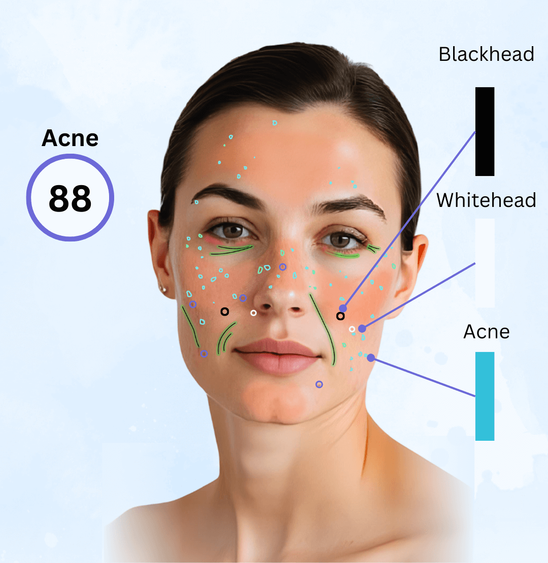 Blemish Type Detection