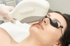 IPL (Intense Pulsed Light) Therapy