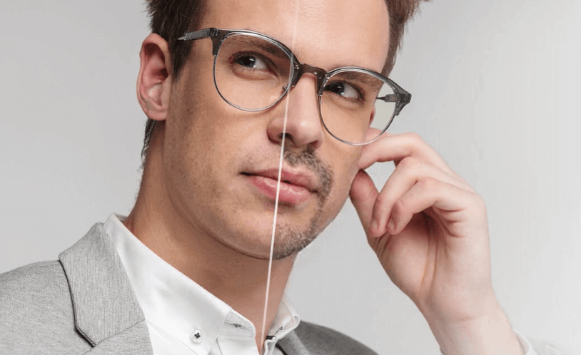 Beard Without Mustache