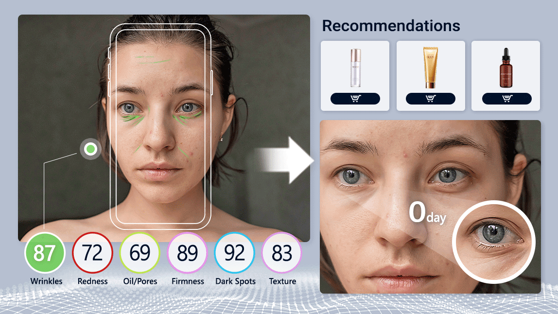 Skin Simulation for Personalized Treatment Previews 