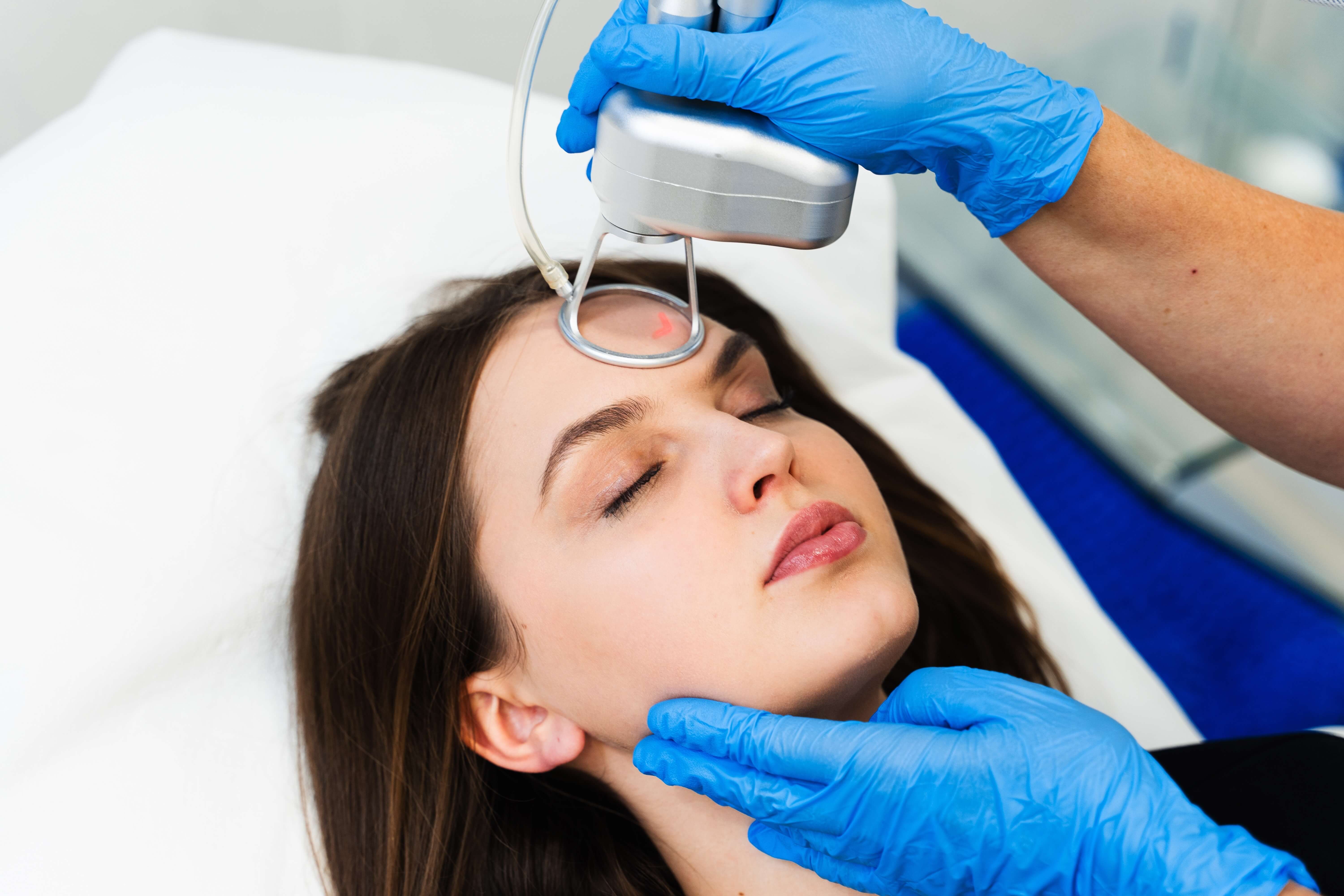 Laser Resurfacing