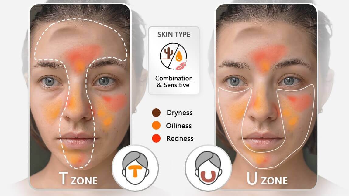 전문의 수준의 피부 타입 분석을 귀사의 웹/앱에 구현