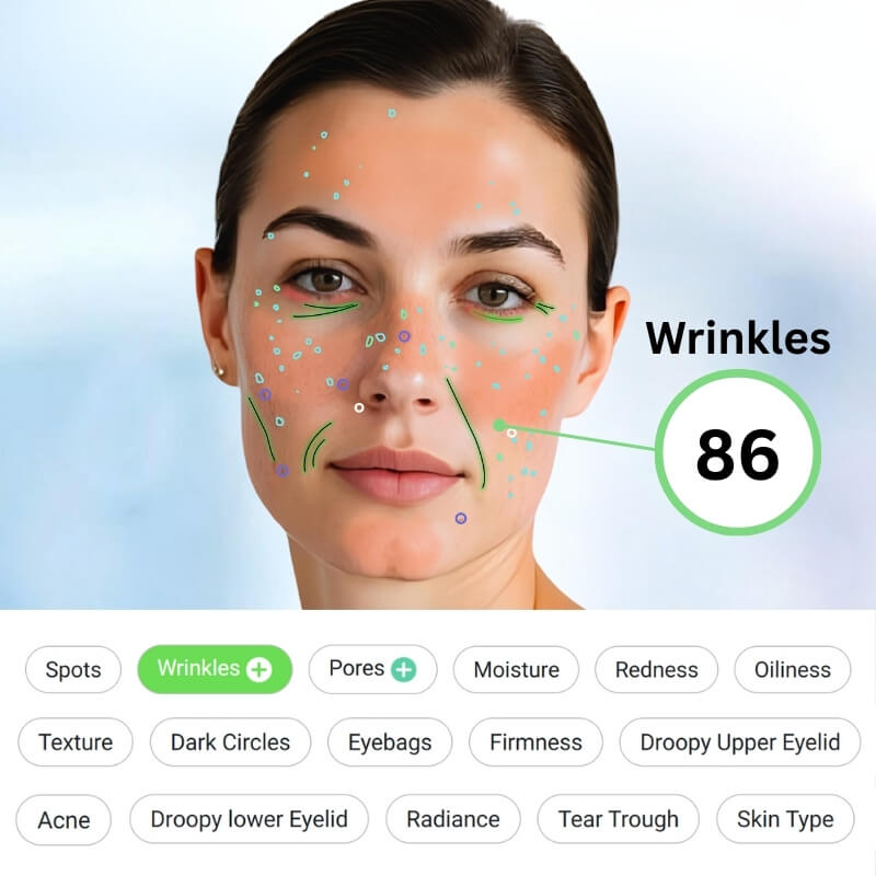 Step 2: AI Dermatologist Detect