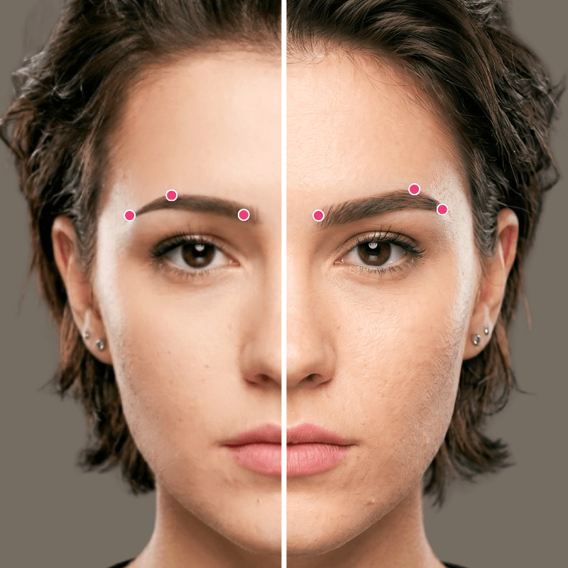 Why the Arch Position Matters