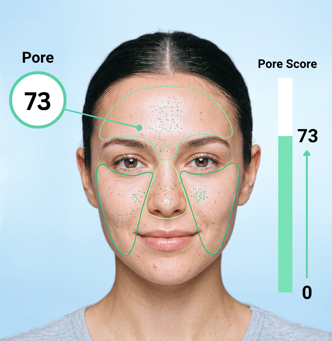 Pore Severity Score