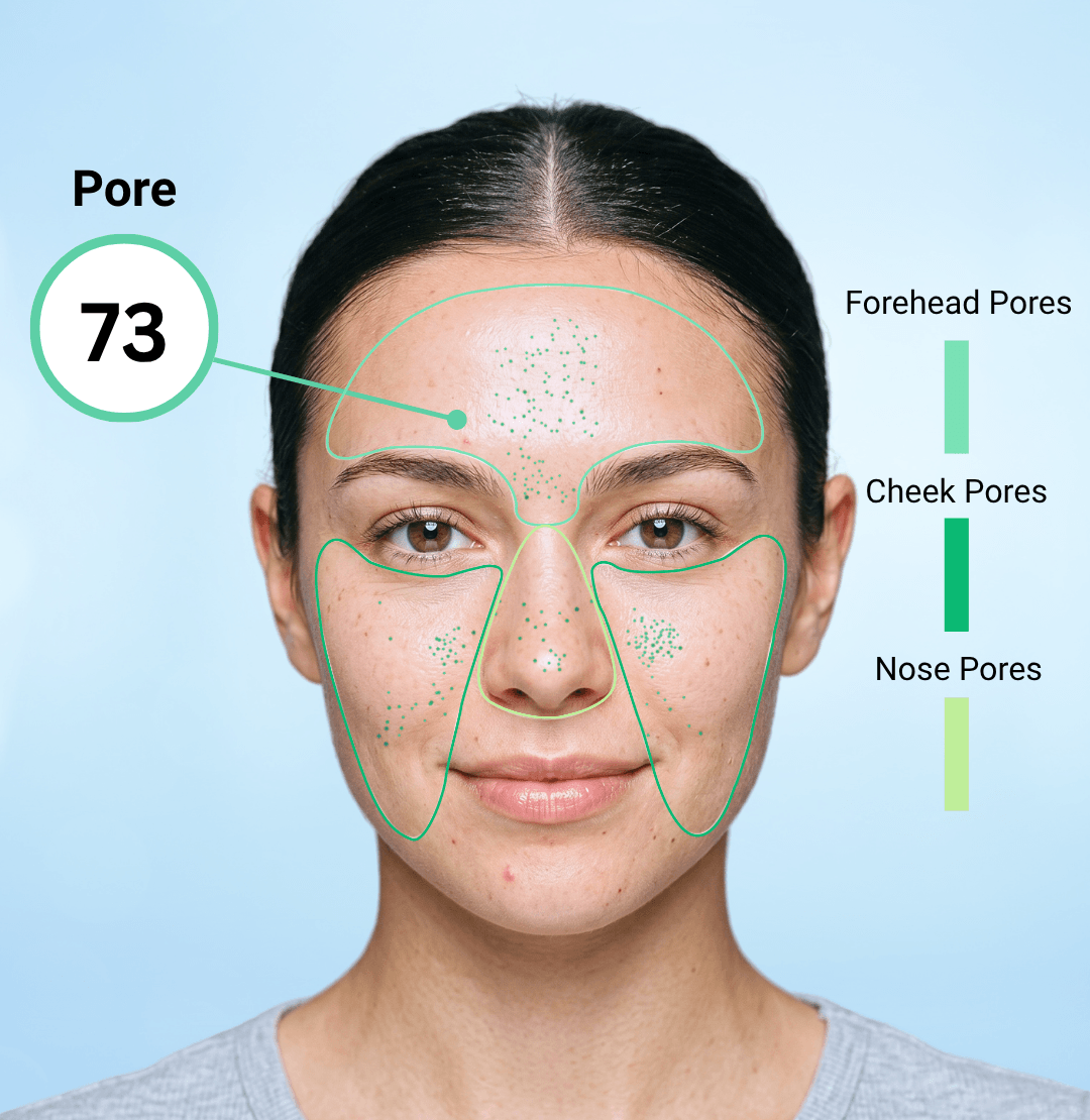 AI Scan Analysis